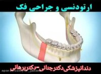 ارتودنسی و جراحی فک