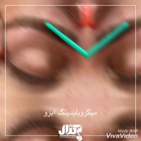 میکرو بلیدینگ ابرو