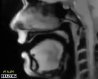 فیلم جالب MRI از صحبت کردن یک انسان - به حرکت زبان توجه کنید