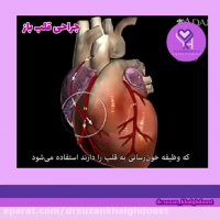 جراحی قلب باز چگونه انجام می شود؟