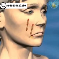 زیبایی صورت