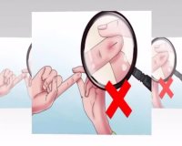 بهداشت دست و پا