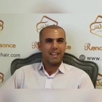 کاشت موی طبیعی در کلینیک تخصصی رنسانس