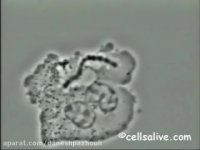 وقتی سلول های ایمنی مغلوب میشوند