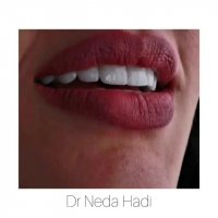 لبخند خود را زیبا کنید