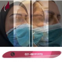 فیلم واقعی کاشت ابرو