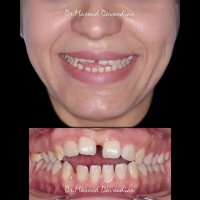 دکتر ارتودنسی | دکتر داوودیان