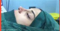 فیلم جراحی بینی 2