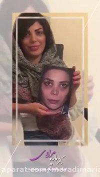 جراحی بینی عروسکی