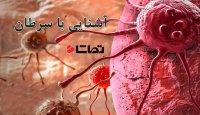 آشنایی با بیماری سرطان و درمان آن