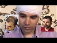 نظر مراجعه کنندگان به درمانگاه و نتیجه کاشت مو طبیعی