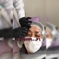 آموزش لیفت ابرو با نخ مجازی یا حضوری ایران زمین