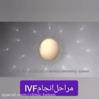 مراحل انجام ivf