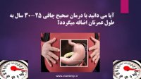 جراحی چاقی و جراحی متابولیک به روش لاپاراسکوپی