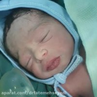 فیلم واقعی زایمان سزارین