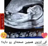 سونوگرافی جنین