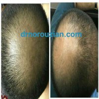 رضایت مصرف کننده از محلول دکترنوروزیان