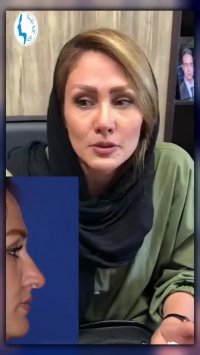 رضایت بیمار سه ماه بعد از جراحی زیبایی بینی