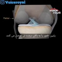 رباط صلیبی چگونه پاره می شود ؟