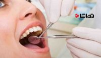 ضرورت مراجعه هر 6 ماه یک بار به دندانپزشک