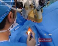 عمل بازآفرینی بینایی در اصفهان