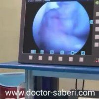توضیح پارگی رباط صلیبی حین عمل توسط دکتر صابری