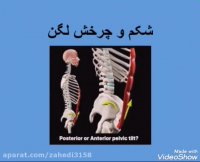 بررسی عضله شکمی از دیدگاه حرکات اصلاحی
