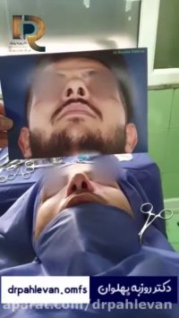 فیلم جراحی بینی