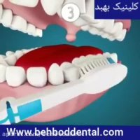 فیلم آموزش نحوه صحیح مسواک زدن