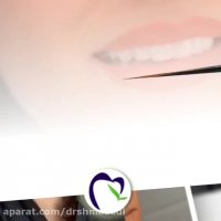 6 واحد لمینت سرامیکی ایمکس در اهواز