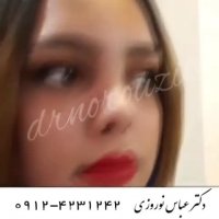فیلم نمونه جراحی بینی توسط دکتر عباس نوروزی