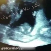 پدری و مادری که آواز می خوانند و جنین در شکم مادر دست می زند