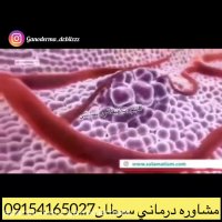 گانودرما جلوي رشد سلول هاي سرطاني را ميگيرد(مشاوره درماني:٠٩١٥٤١٦٥٠٢٧)