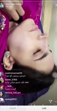 داستان جراحی بینی