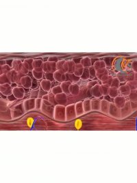 فیلم انیمیشن میکرونیدلینگ صورت