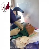 آیا می دانید تزریق چربی و مدلینگ صورت چگونه انجام می شود؟