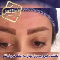 فیلم کاشت ابرو -کلینیک تخصصی رنسانس