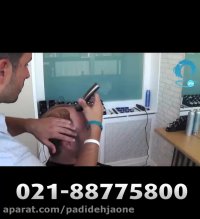 روش ترمیم مو بدون جراحی