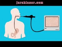 انواع آندوسکوپی و مراحل انجام و خطرات آن - کلینیک مهنا