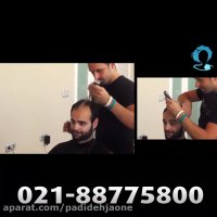 روش ترمیم مو بدون جراحی