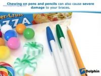 دکتر مسعود داودیان :: ملاحظات تغذیه ای حین درمان ارتودنسی