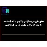 اصلاح انحراف انگشت پا