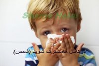 علت بینی گرفتگی دائمی