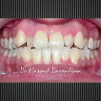 ارتودونسی شرق تهران | دکتر داوودیان