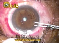 شکوه شیخی پور ، مدرس اسکراب نرس چشم پزشکی