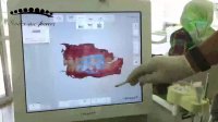قالب گیری دیجیتال دندان با دستگاه اسکنر