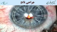 فیلم عمل prk (پی آر کی)