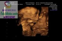 توانبخشی درکرج  09121623463  عظیمیه خیابان طالقانی گلستان18