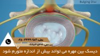 هر آنچه درباره دیسک کمر باید بدانید