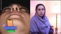 فیلم رضایت بیمار از جراحی زیبایی بینی
